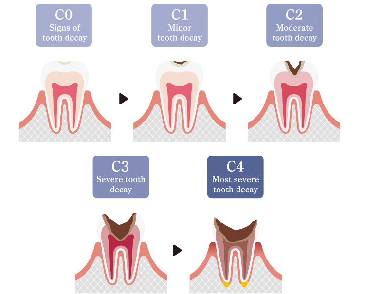 Toothache, sesitive teeth